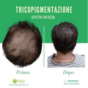 Medical Capelli - Tricopigmentazione