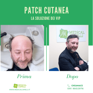 Medical Capelli - Patch Cutanea